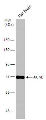 Acetylcholinesterase Antibody in Western Blot (WB)