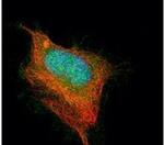 Acetylcholinesterase Antibody in Immunocytochemistry (ICC/IF)