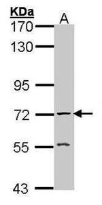 Acetylcholinesterase Antibody in Western Blot (WB)