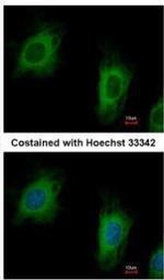 TTC1 Polyclonal Antibody