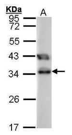 TTC1 Antibody in Western Blot (WB)