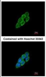 LTBP4 Antibody in Immunocytochemistry (ICC/IF)