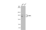 LTBP4 Antibody in Western Blot (WB)