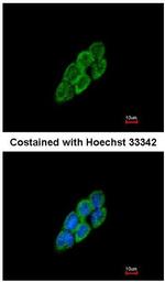 LTBP4 Antibody in Immunocytochemistry (ICC/IF)