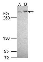 LTBP4 Antibody in Western Blot (WB)