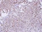 PSMA7 Polyclonal Antibody