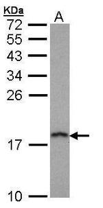 PFDN5 Polyclonal Antibody