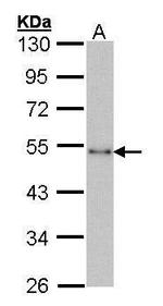 CtBP1 Antibody in Western Blot (WB)