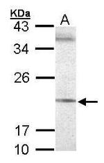 SEC61G Polyclonal Antibody