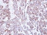 RRBP1 Antibody in Immunohistochemistry (Paraffin) (IHC (P))