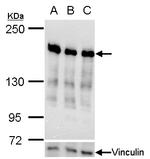 RRBP1 Antibody in Western Blot (WB)