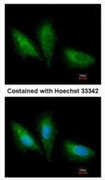 PRKCSH Antibody in Immunocytochemistry (ICC/IF)