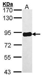 PRKCSH Antibody in Western Blot (WB)