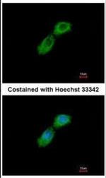 CKAP1 Polyclonal Antibody