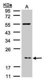 p21 ARC Antibody in Western Blot (WB)