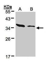 ARPC2 Antibody in Western Blot (WB)