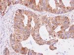 DNPEP Polyclonal Antibody