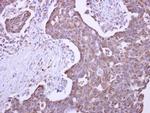 MLEC Polyclonal Antibody