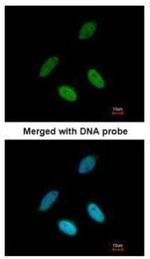 TAP Polyclonal Antibody