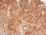 ADAMTSL2 Polyclonal Antibody