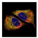 beta-4 Tubulin Antibody in Immunocytochemistry (ICC/IF)
