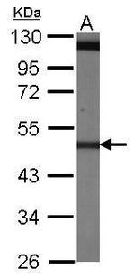 beta-4 Tubulin Antibody in Western Blot (WB)