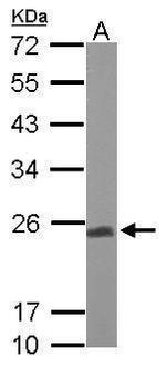 UQCRFS1 Antibody in Western Blot (WB)