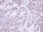 GANAB Polyclonal Antibody