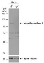 GANAB Antibody in Western Blot (WB)