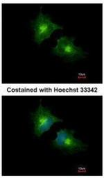SCAMP3 Polyclonal Antibody