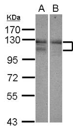 ARHGEF18 Antibody in Western Blot (WB)