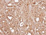 RPL13A Antibody in Immunohistochemistry (Paraffin) (IHC (P))