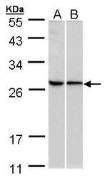 RPL13A Antibody in Western Blot (WB)