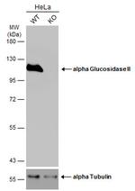 GANAB Antibody in Western Blot (WB)