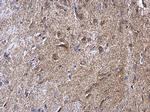 NDUFV2 Antibody in Immunohistochemistry (Paraffin) (IHC (P))