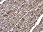 NDUFV2 Polyclonal Antibody