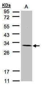 NDUFV2 Antibody in Western Blot (WB)
