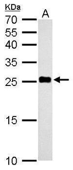 NDUFV2 Antibody in Western Blot (WB)