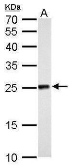 NDUFV2 Antibody in Western Blot (WB)