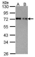 NUP62 Antibody in Western Blot (WB)