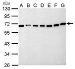 NUP62 Antibody in Western Blot (WB)