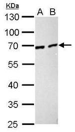 NUP62 Antibody in Western Blot (WB)