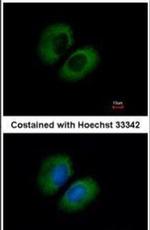 CACNA1B Antibody in Immunocytochemistry (ICC/IF)