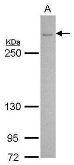 CACNA1B Antibody in Western Blot (WB)