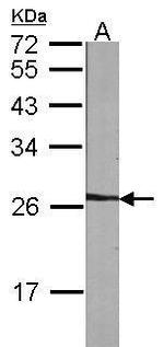 NME5 Antibody in Western Blot (WB)