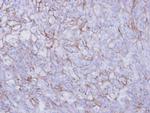 Desmoglein 2 Antibody in Immunohistochemistry (Paraffin) (IHC (P))