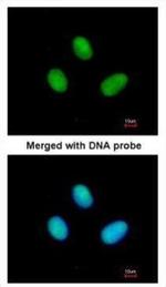 POLR2B Polyclonal Antibody