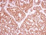 POLR2B Antibody in Immunohistochemistry (Paraffin) (IHC (P))