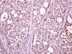 POLR2B Antibody in Immunohistochemistry (Paraffin) (IHC (P))