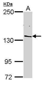 POLR2B Antibody in Western Blot (WB)